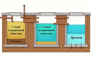 Автономная канализация